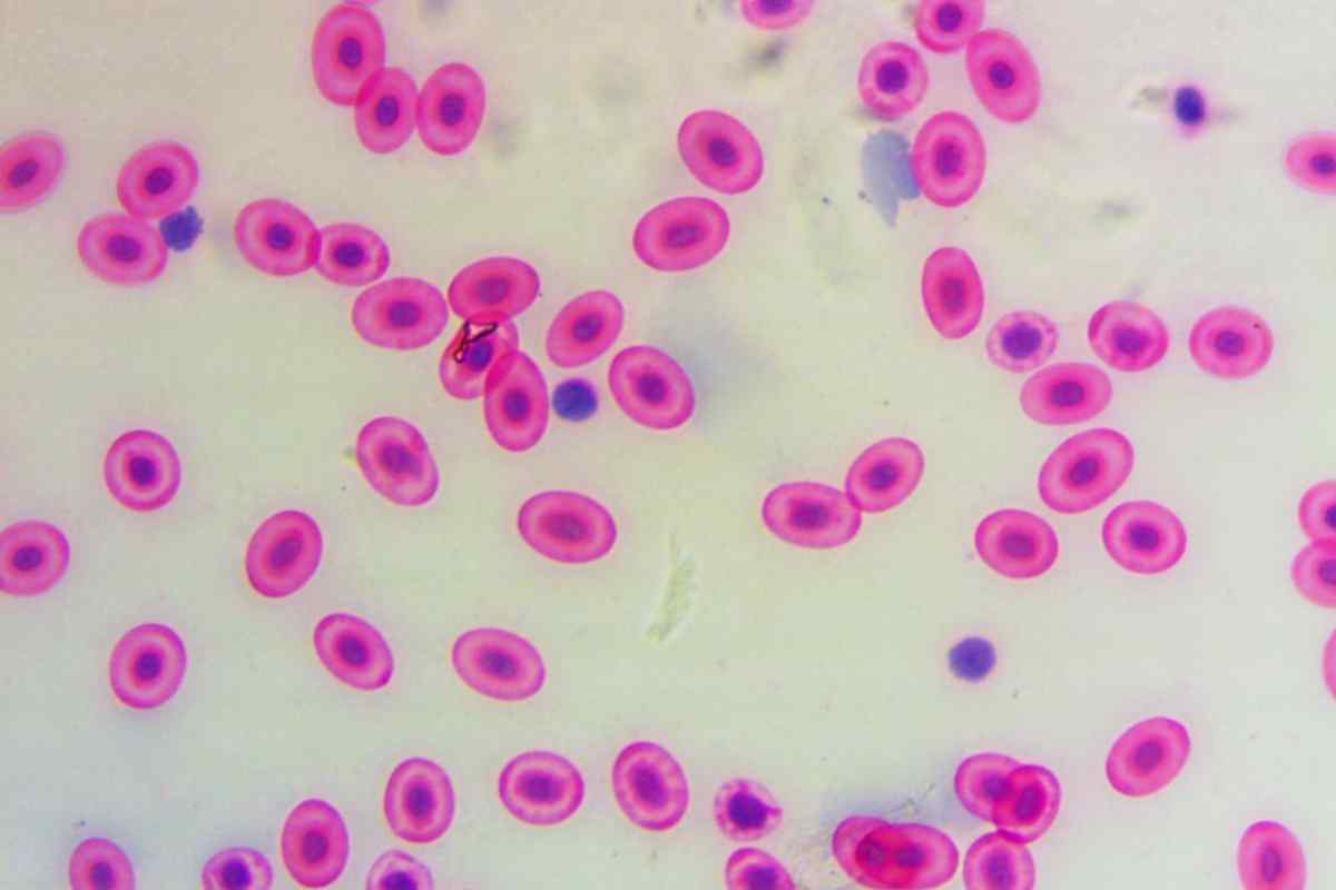 Лейкоцити в сечі у дитини підвищені, або Перші ознаки інфекції