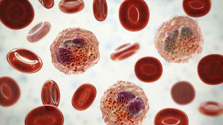 Лейкоцити в мазку: причини та лікування
