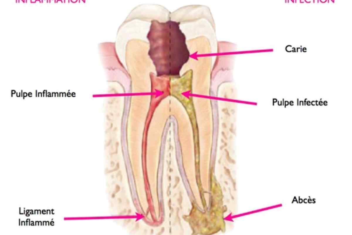 Будова зуба людини в розрізі