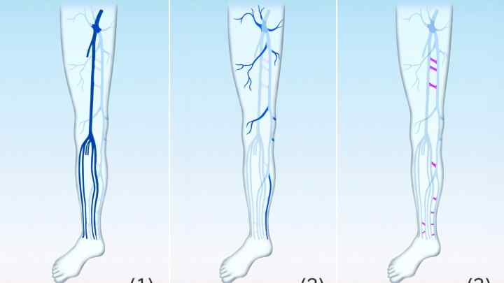 Артерії верхньої кінцівки. Судини верхньої кінцівки
