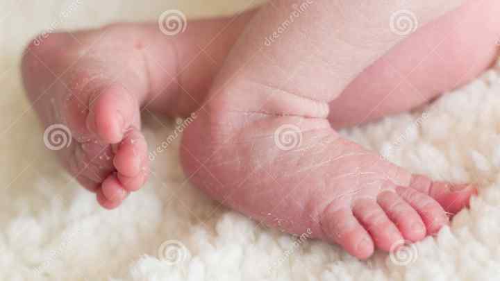 Чому облазить шкіра у новонародженого? Причини