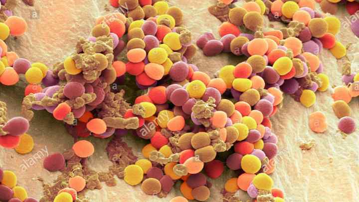 Чим небезпечний Staphylococcus aureus?