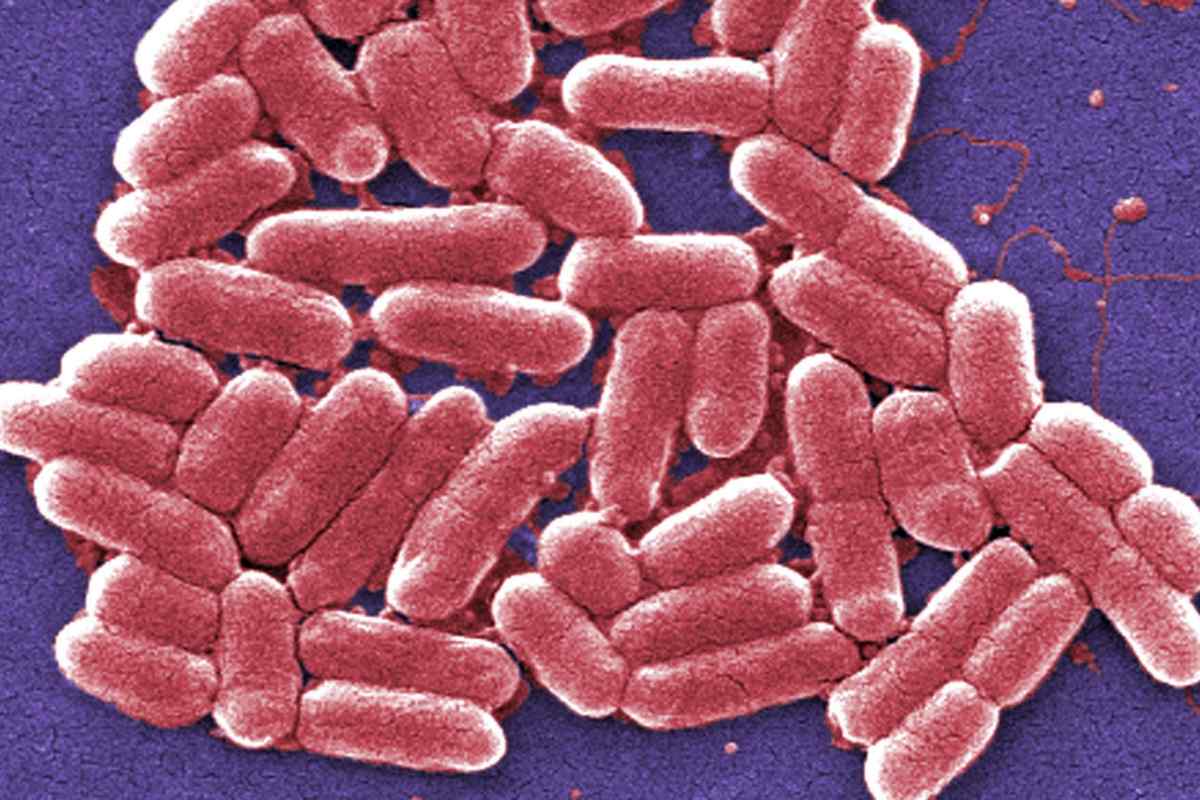 E. coli лактозонегативні: що це і як лікувати?