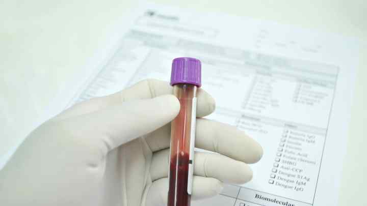Загальний аналіз крові. Звідки беруть кров у дітей і дорослих при загальному аналізі крові