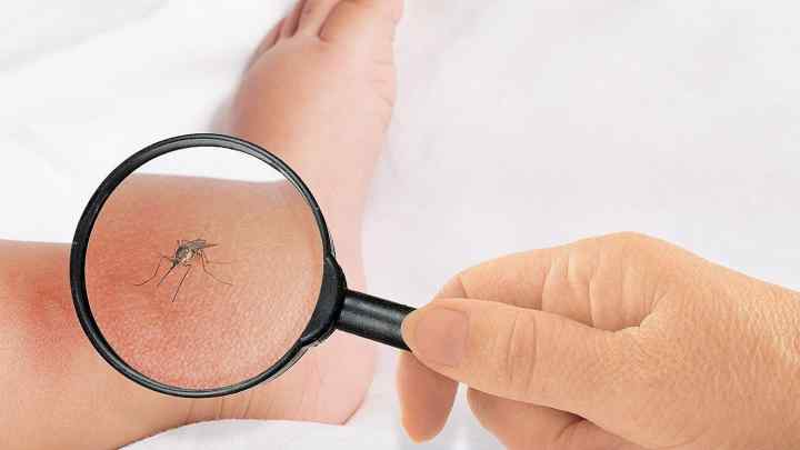Від укусу комахи пухлина і почервоніння: що робити, чим лікувати?