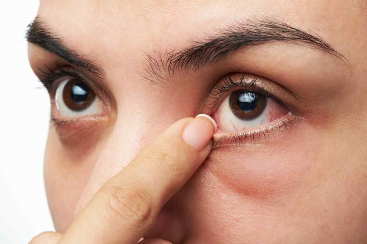 Плівка на оці у людини: причини та лікування