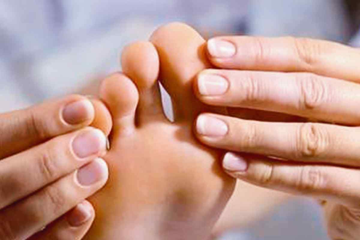 Молоткоподібні пальці стопи: симптоми, причини, профілактика та особливості лікування