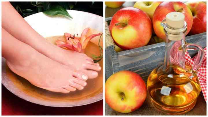 Яблучний оцет від целюліту, рубців і при варикозі: поради