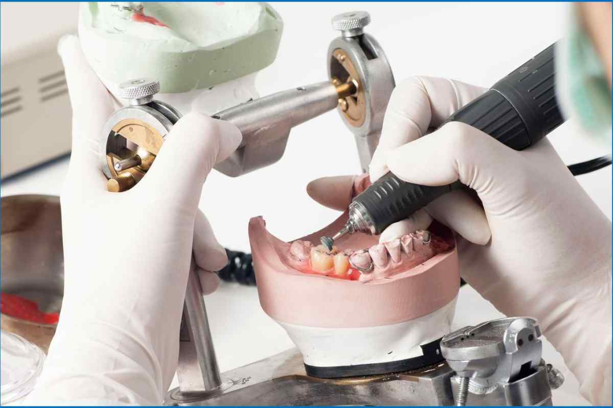 Ремонт зубного протезу в домашніх умовах: особливості та рекомендації