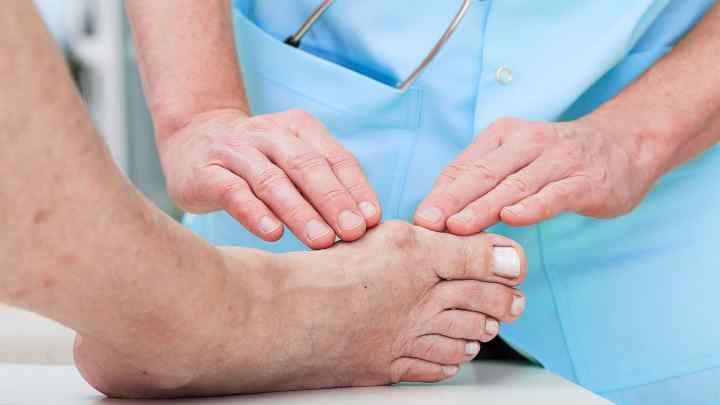 Артрит стопи: причини, симптоми, методи лікування та профілактики