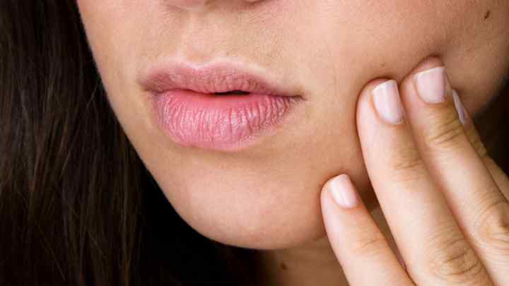 Чому утворюються заїди в куточках рота: лікування