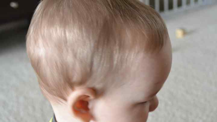 Деформація черепа у дітей: причини та способи виправлення