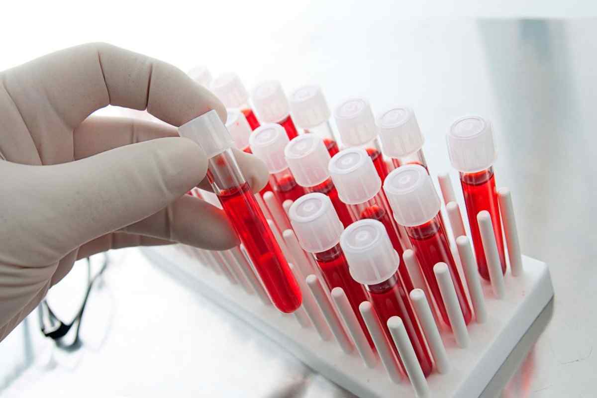 Палички в крові: види аналізу, підготовка до забору крові, норма і патологія, причини підвищення, можливі захворювання