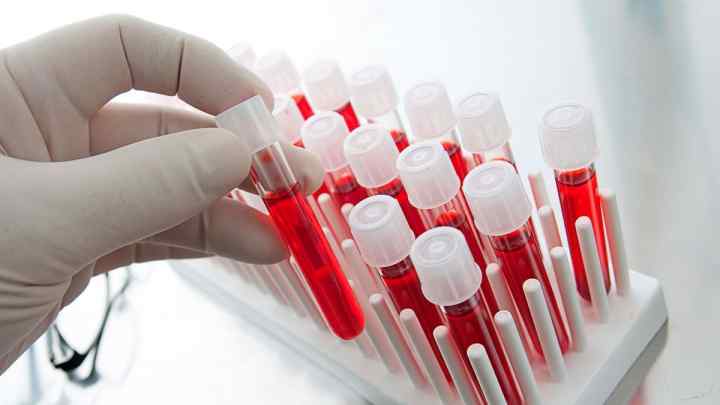 Палички в крові: види аналізу, підготовка до забору крові, норма і патологія, причини підвищення, можливі захворювання
