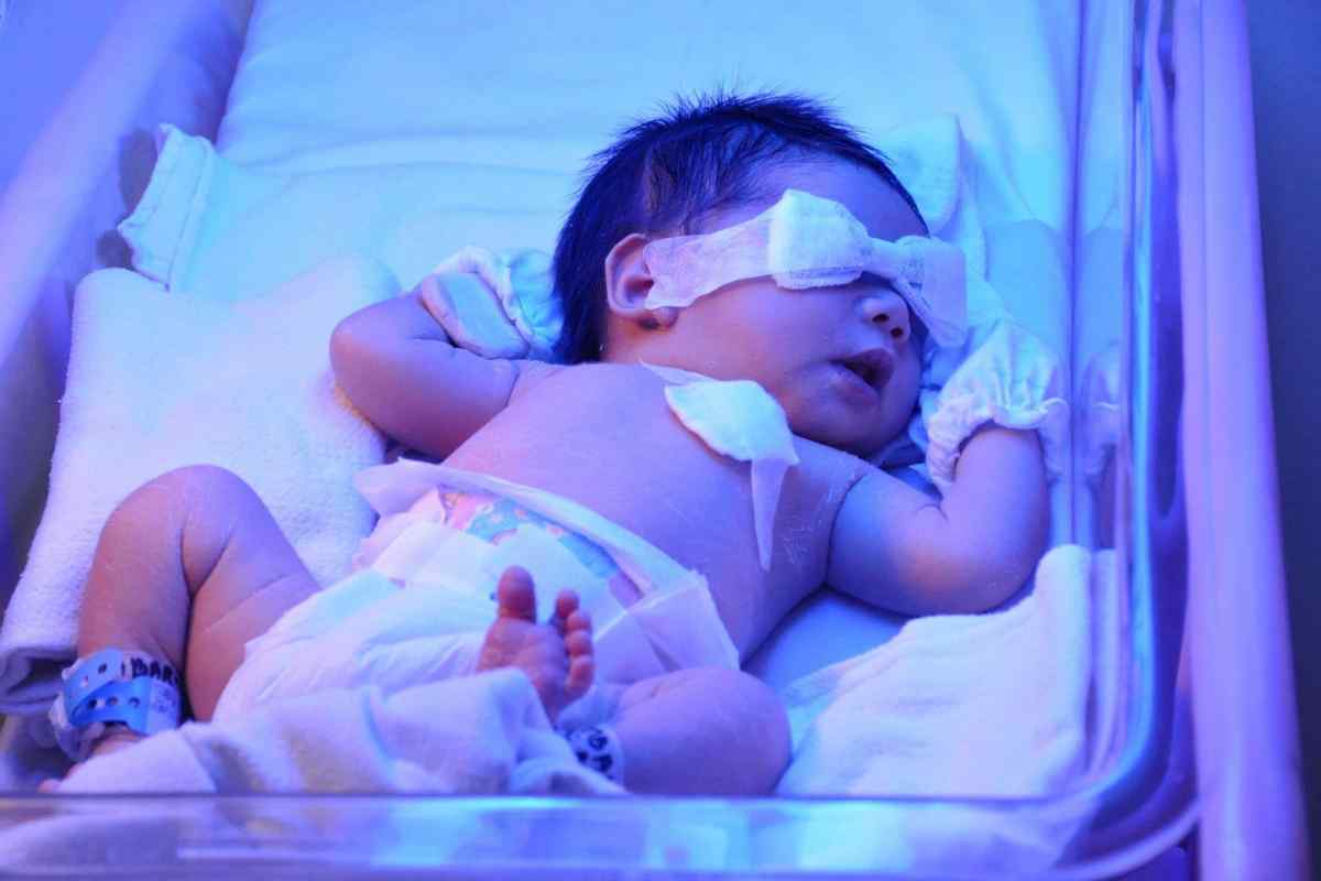 Білірубін 300 у новонародженого: причини відхилення і лікування