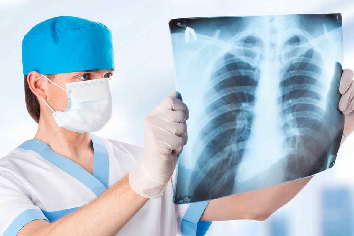 Що показує рентген черевної порожнини? Де зробити? Призначення лікаря, техніка проведення, свідчення, протипоказання, виявлені захворювання та їх лікування