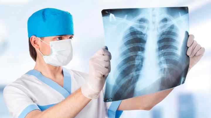 Що показує рентген черевної порожнини? Де зробити? Призначення лікаря, техніка проведення, свідчення, протипоказання, виявлені захворювання та їх лікування