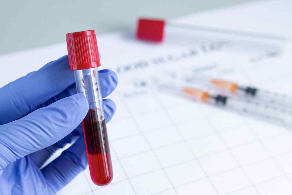 Гемоглобін 100: призначення, алгоритм забору крові, проведення аналізів, розшифровка результату, причини низького гемоглобіну та консультація лікаря