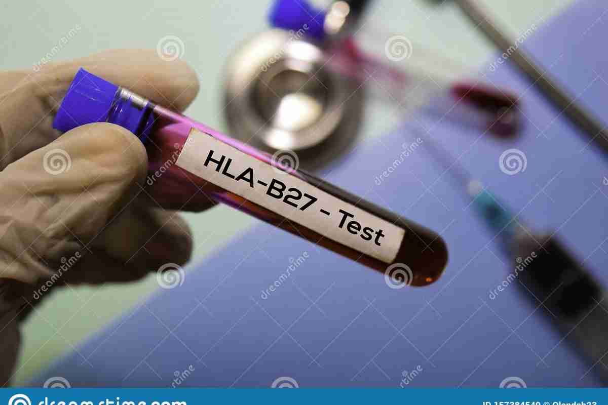 HLA-B27 - що це? Виявлення гена гістосумісності