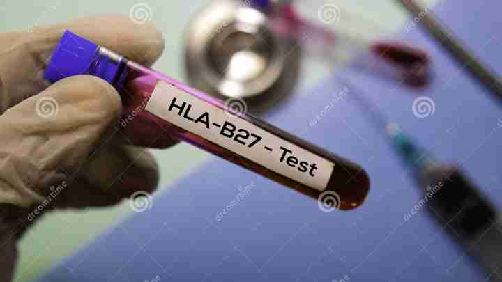HLA-B27 - що це? Виявлення гена гістосумісності