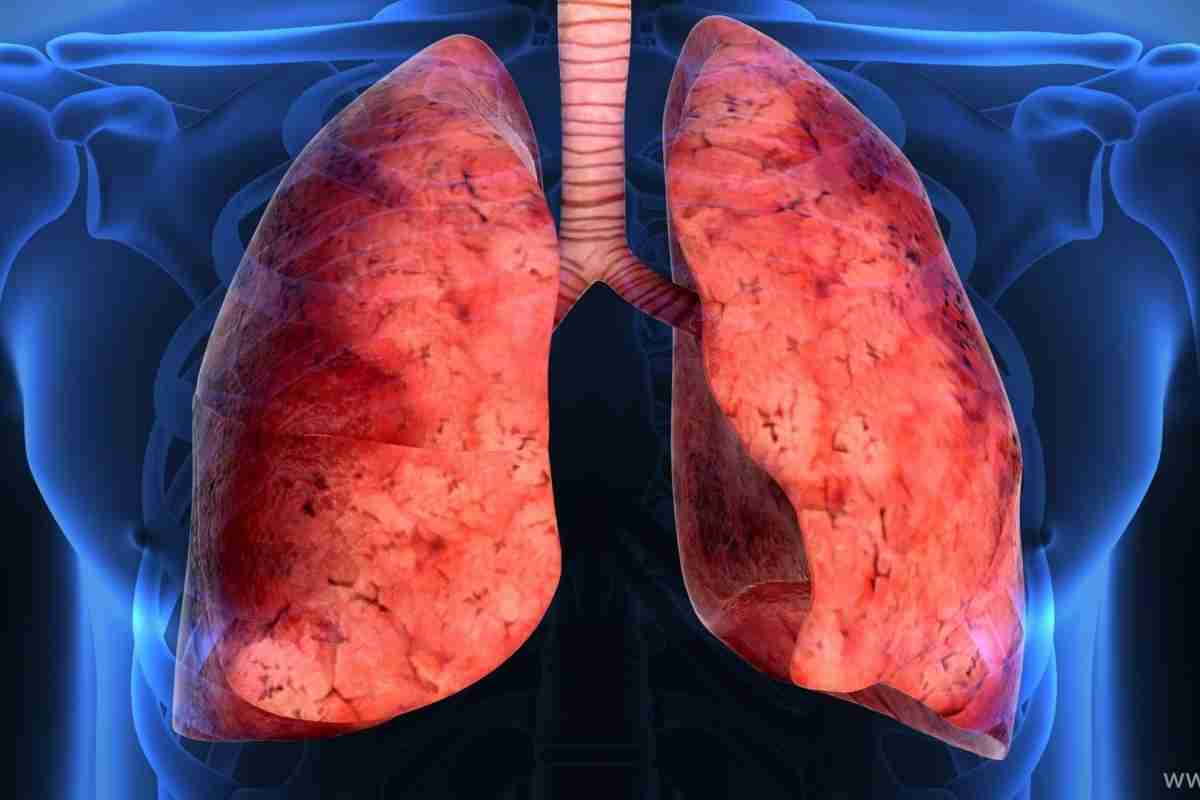 Лікується туберкульоз чи ні? Методи лікування