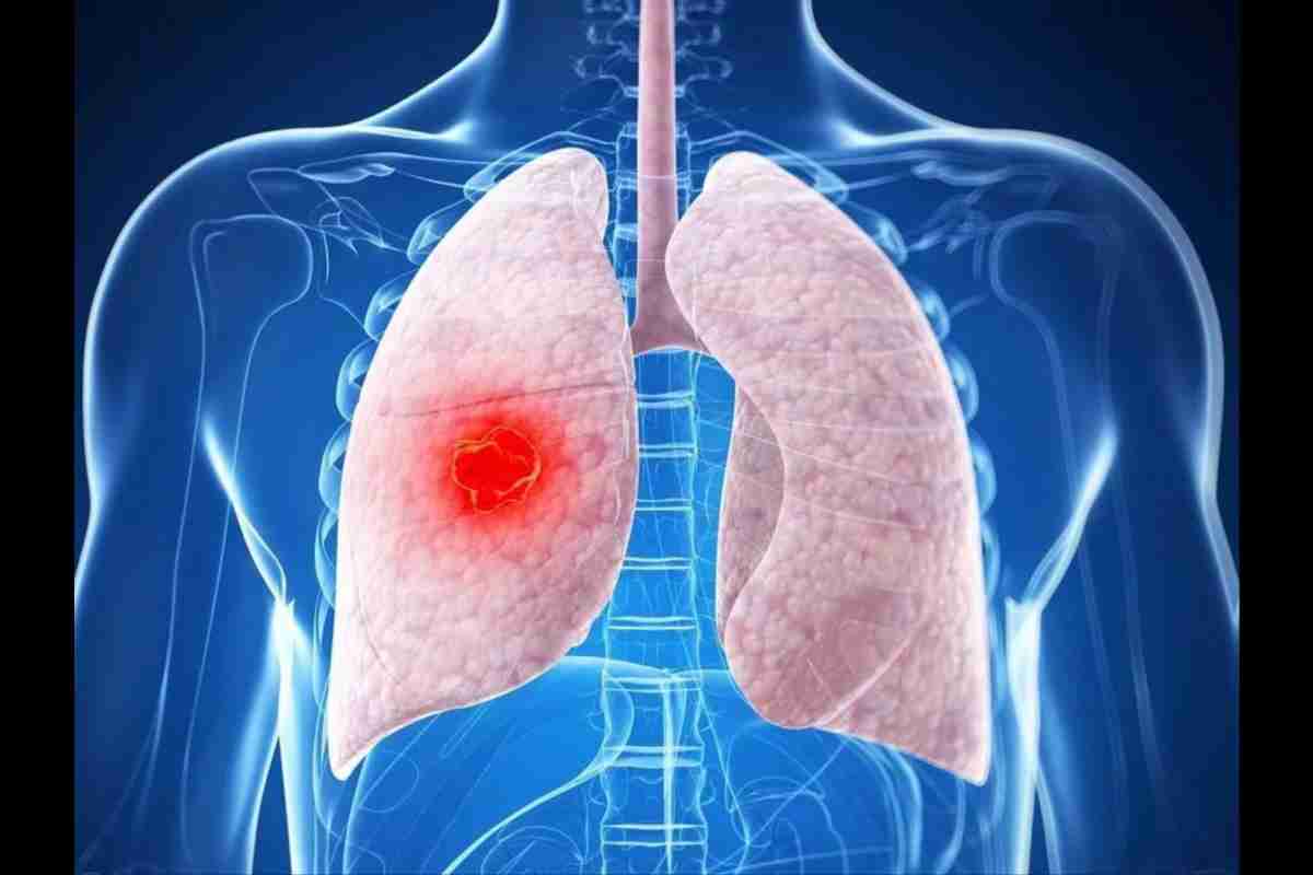 Чому і як болять легені? Болять легені при вдиху: причини, діагностика та лікування