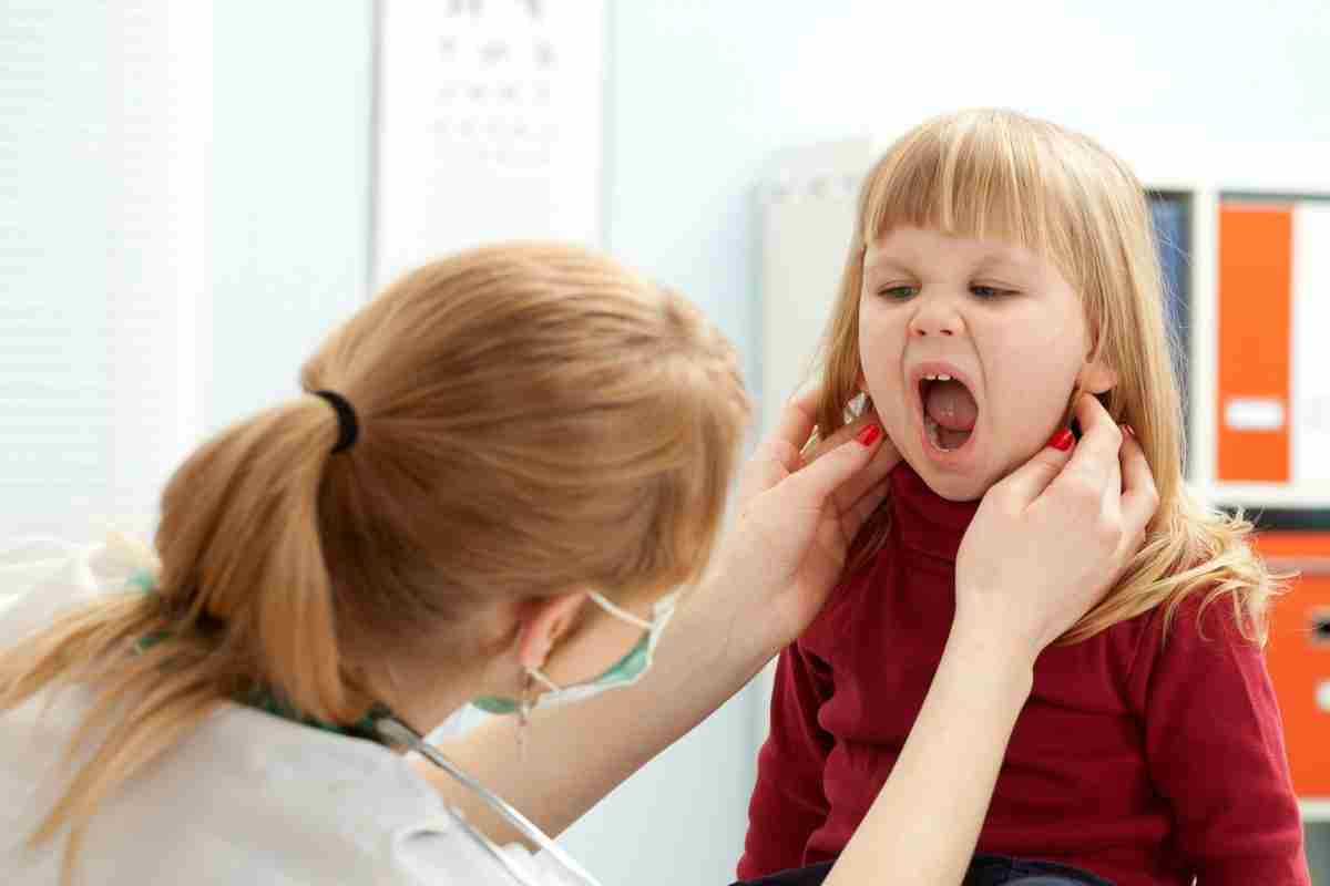 Вирусный мононуклеоз у детей горло