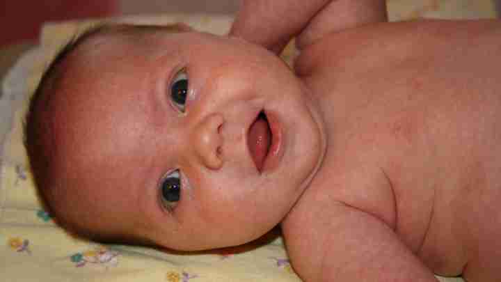 Везикулопустулез у новонароджених: збудники, симптоми та лікування