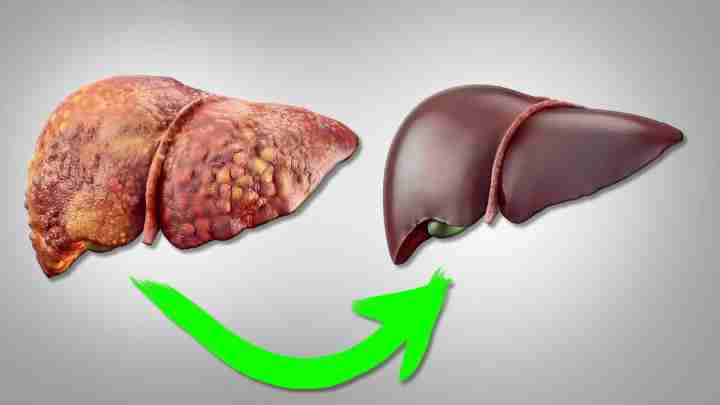 Чим небезпечні кісти печінки, як лікувати захворювання