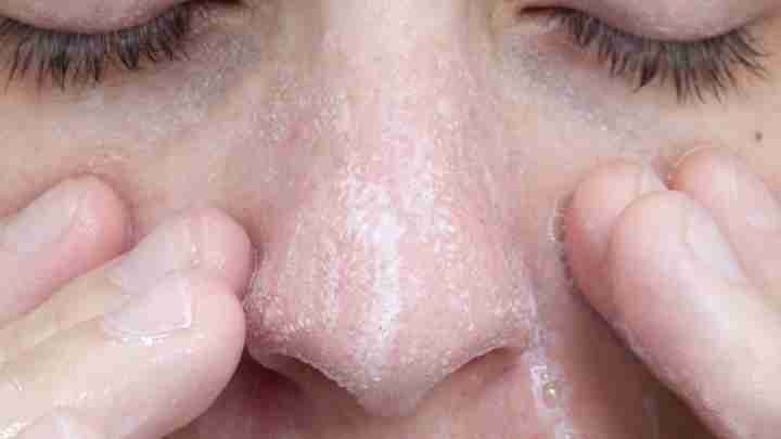 У носі постійно утворюються болячки... Чим лікувати?