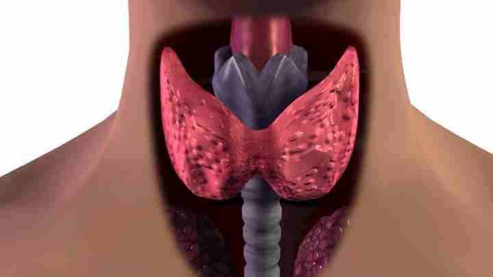 Колоїдний зоб щитовидної залози - що це таке? Як лікувати колоїдний зоб щитоподібної залози