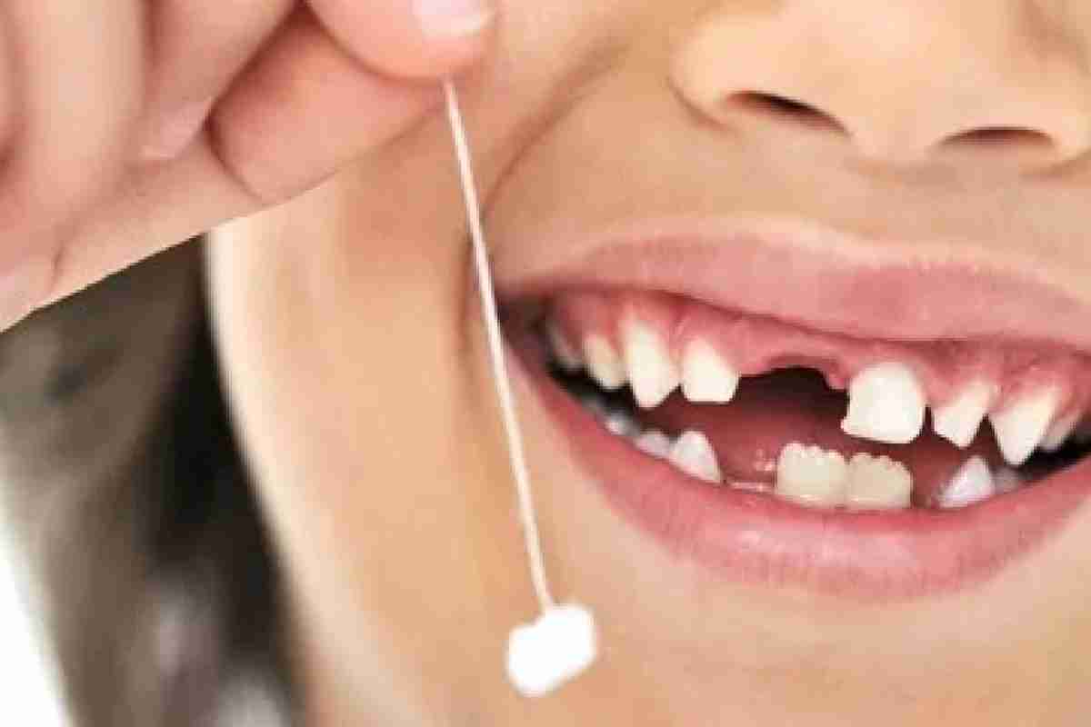 Коли ростуть зуби мудрості - вік, симптоми і особливості процесу