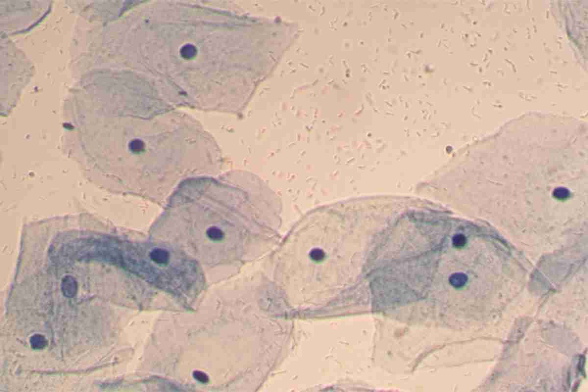 Трихомонады в мазке у женщин фото под микроскопом