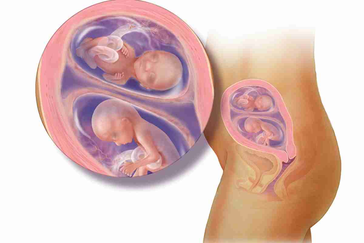 УЗИ 16 недель беременности двойня