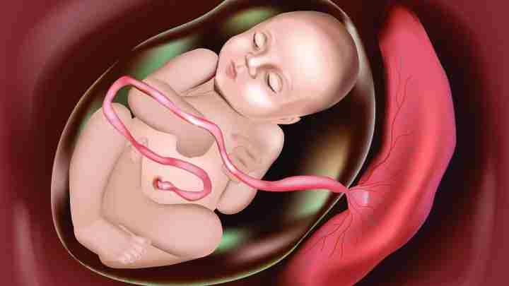 Відшарування плаценти на ранніх термінах вагітності: можливі причини і наслідки