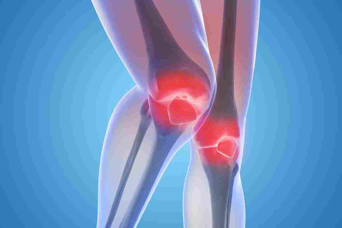 Уколи в колінний суглоб при артрозі: препарати. Артроз колінного суглоба: симптоми і лікування