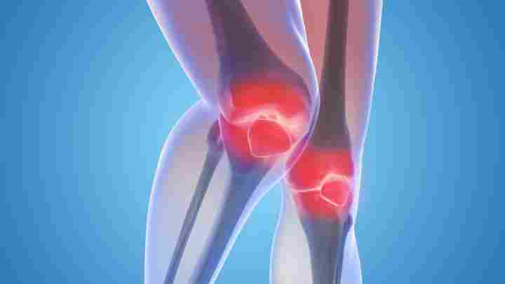 Уколи в колінний суглоб при артрозі: препарати. Артроз колінного суглоба: симптоми і лікування