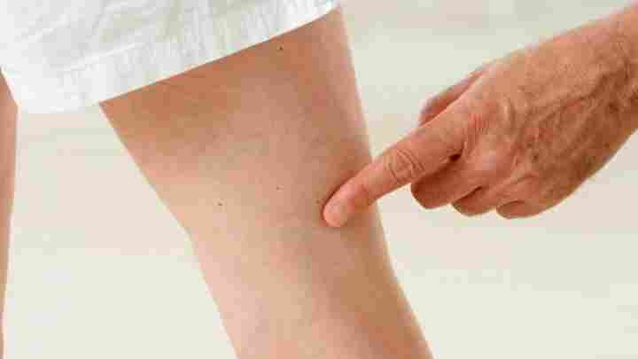 Болять вени на ногах: що робити, чим лікувати?