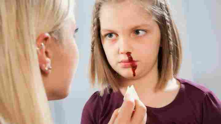 Причини носових кровотечей у дорослих і перша допомога