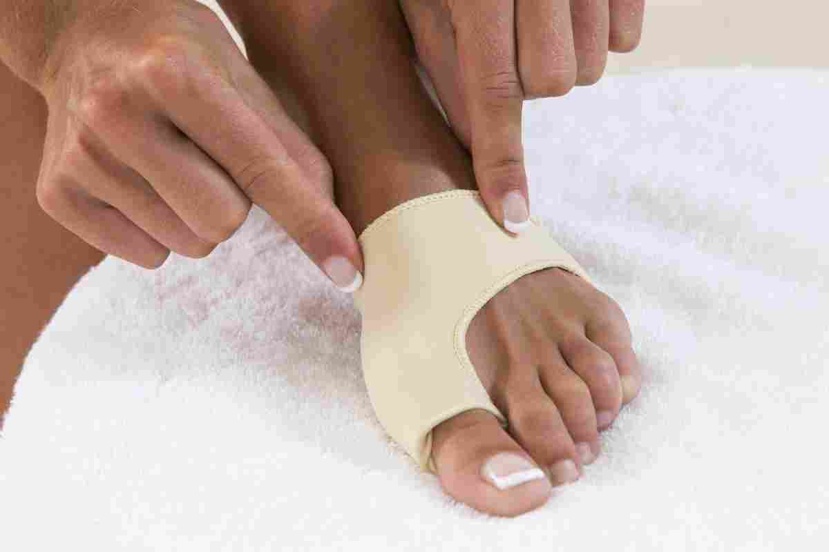 Лікування вальгусної деформації великого пальця стопи: коректор, операція та інші засоби лікування