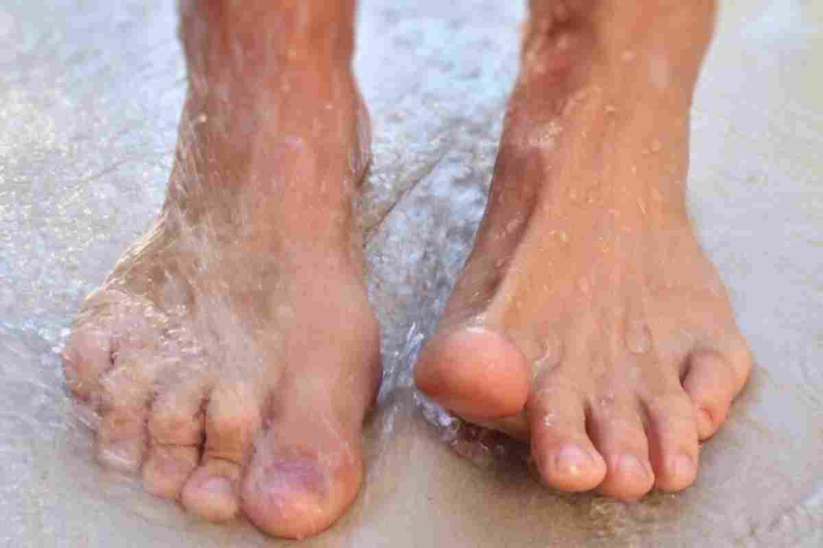 Пітливість ніг: лікування і причини