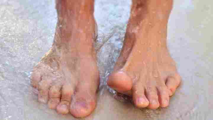 Пітливість ніг: лікування і причини