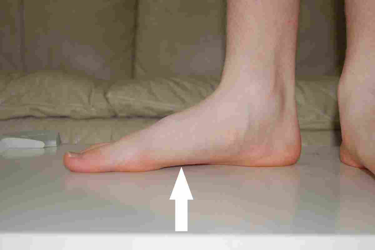 Flatfoot або чому болять ноги