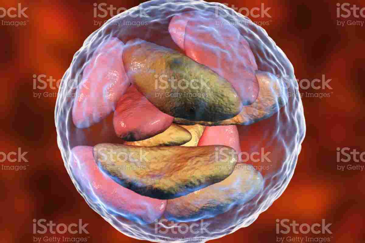 Toxoplasma gondii. Токсоплазмоз у людини: симптоми, шляхи зараження, діагностика та лікування