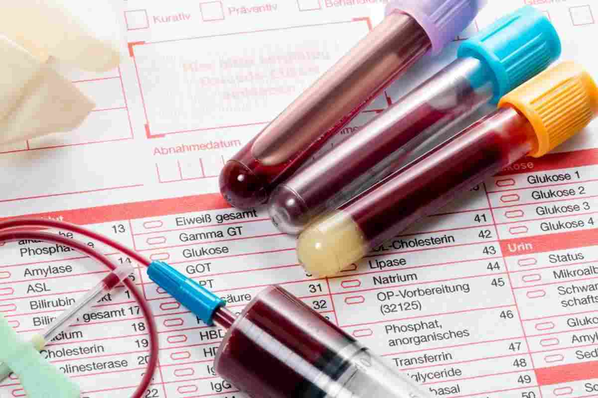 У дорослого підвищені еозинофіли - всі причини і способи корекції важливого показника крові