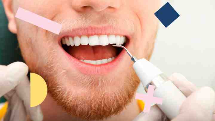 Что такое зубной камень? 7 советов, как уменьшить отложения