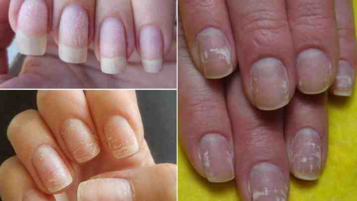 Як визначити міцність нігтів