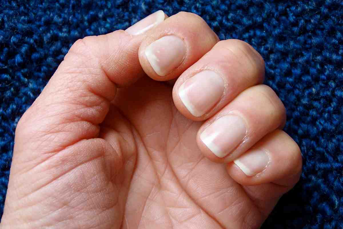 Як позбутися розшарування нігтів