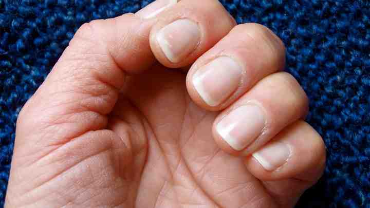 Як позбутися розшарування нігтів