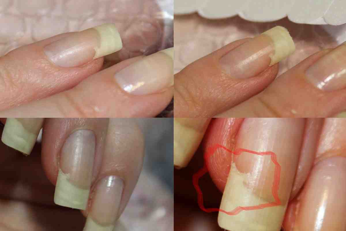 Як поліпшити стан нігтів